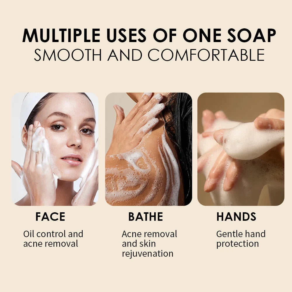 🧼Paquete de 5 Jabones Naturally Magic™ de Cúrcuma y Ácido Kójico de 100 g – Fórmula con Vitamina C Natural | Barra limpiadora profunda, iluminadora e hidratante para rostro y cuerpo